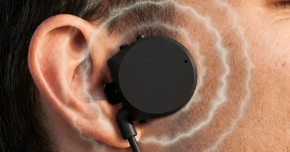 Les Auricle awareONE n'utilisent ni des écouteurs classiques ni vraiment la conduction osseuse